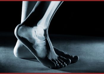 Ankle Replacement Surgery Cost in India