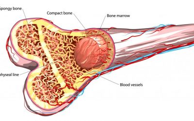 Bone Marrow Transplant Cost In India